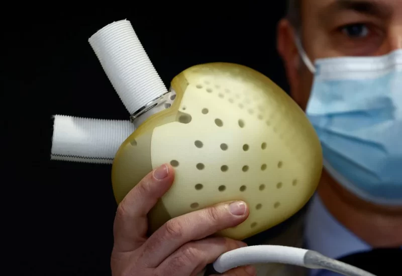 Chief Executive Officer of French artificial heart manufacturer Carmat, Stephane Piat, poses holding an artificial heart during an interview with Reuters in Velizy, near Paris, January 11, 2021. REUTERS/Christian Hartmann/Files
