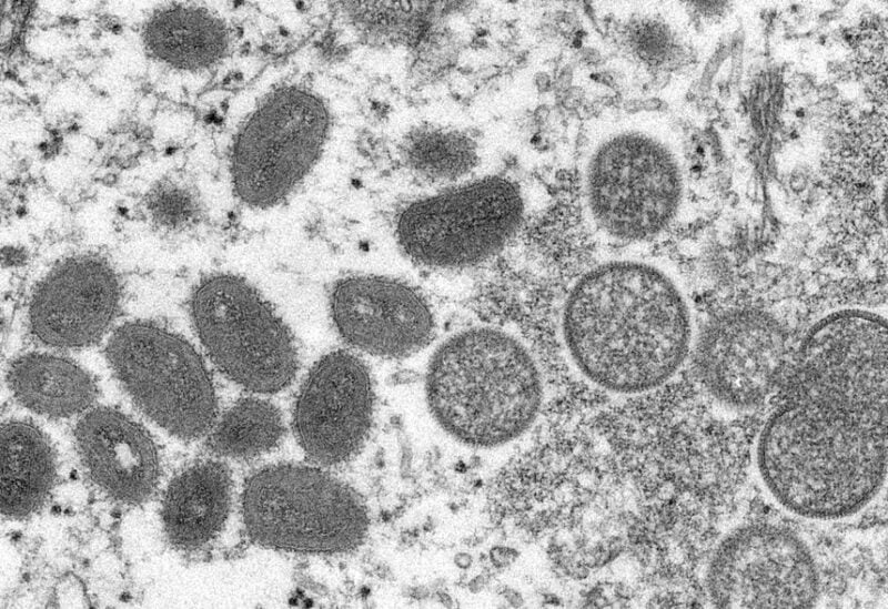 An electron microscopic (EM) image shows mature, oval-shaped monkeypox virus particles as well as crescents and spherical particles of immature virions, obtained from a clinical human skin sample associated with the 2003 prairie dog outbreak in this undated image obtained by Reuters on May 18, 2022. Cynthia S. Goldsmith, Russell Regnery/CDC/Handout via REUTERS