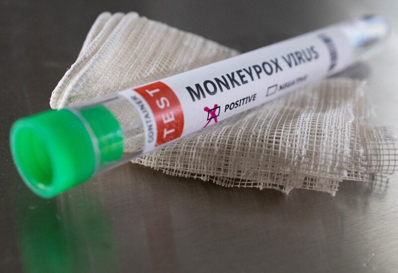 FILE PHOTO: Test tube labelled "Monkeypox virus positive" are seen in this illustration taken May 22, 2022. REUTERS/Dado Ruvic/Illustration/File Photo