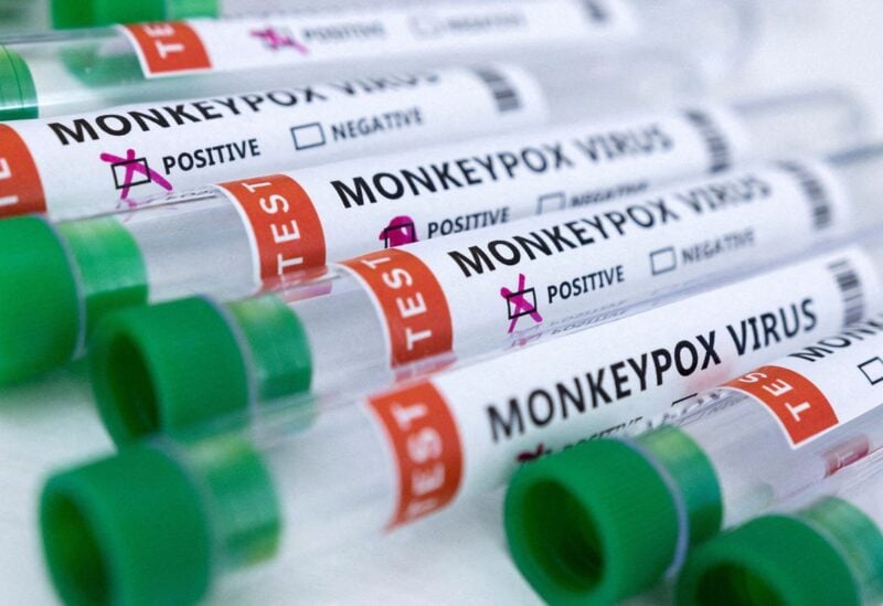 Test tubes labeled "Monkeypox virus positive and negative" are seen in this illustration taken May 23, 2022. REUTERS/Dado Ruvic/Illustration/File Photo