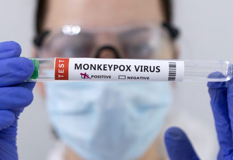 Test tubes labelled "Monkeypox virus positive" are seen in this illustration taken May 23, 2022. REUTERS/Dado Ruvic/Illustration/File Photo