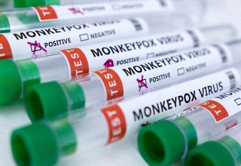 Test tubes labeled "Monkeypox virus positive and negative" are seen in this illustration taken May 23, 2022. REUTERS/Dado Ruvic/Illustration