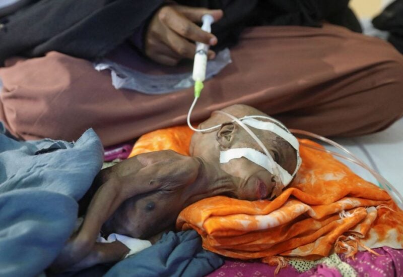 Zamzam Jamac, a Somali woman displaced by the worsening drought due to failed rain seasons, feeds her child Fatuma Botan, 1, through a nasogastric tube at the paediatric ward in the Banadir Hospital, in Mogadishu, Somalia September 24, 2022. REUTERS/Feisal Omar