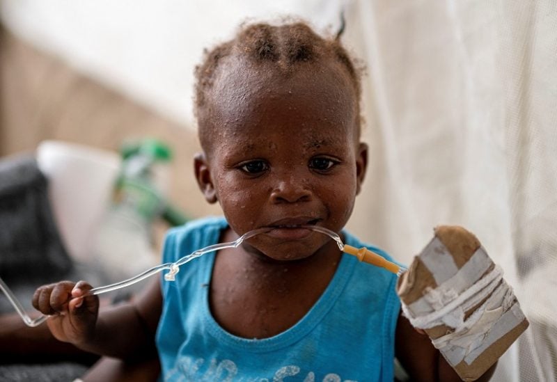 2-year-old child Holanda Sineus receives treatment for cholera in a tent at a Doctors Without Borders hospital in Cite Soleil, a densely populated commune of Port-au-Prince, Haiti October 15, 2022. REUTERS/Ricardo Arduengo