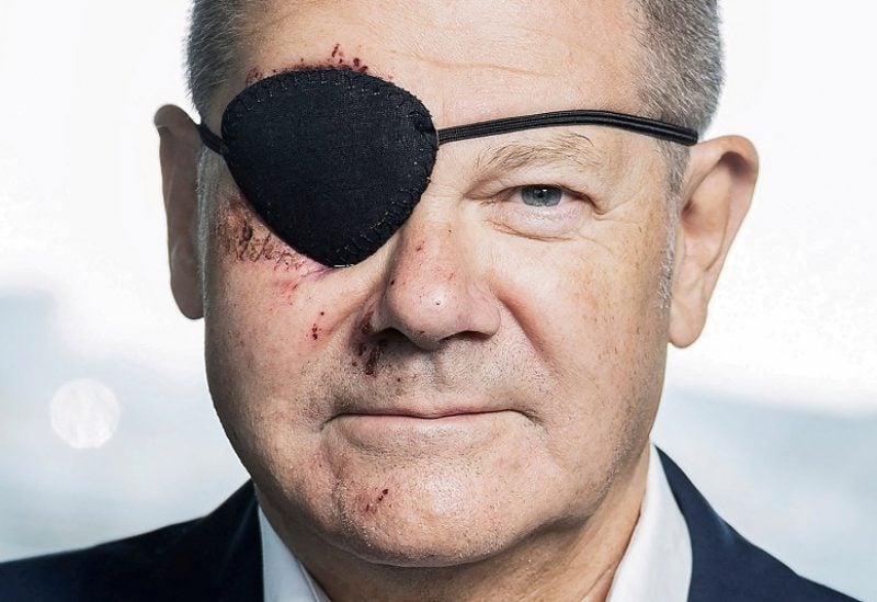 German Chancellor wears an eye patch following his jogging injury in this handout image released in Berlin by the Bundespresseamt in Berlin, Germany, September 4, 2023. Steffen Kugler/BPA/Handout via REUTERS ATTENTION EDITORS